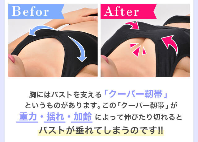 ナイトブラ