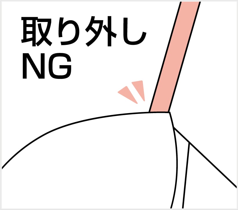 ストラップ取り外し不可